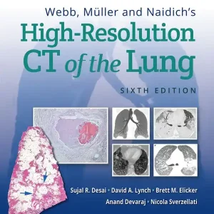 Fynd Webb, Müller and Naidich's High-Resolution CT of the Lung